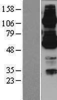 ABCB7 Protein - Western validation with an anti-DDK antibody * L: Control HEK293 lysate R: Over-expression lysate