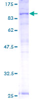 ABCB7 Protein - 12.5% SDS-PAGE of human ABCB7 stained with Coomassie Blue