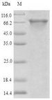 ABCB8 Protein - (Tris-Glycine gel) Discontinuous SDS-PAGE (reduced) with 5% enrichment gel and 15% separation gel.