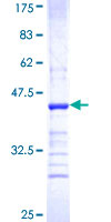 ABCB9 Protein - 12.5% SDS-PAGE Stained with Coomassie Blue.