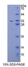 ABCB9 Protein - Recombinant ATP Binding Cassette Transporter B9 (ABCB9) by SDS-PAGE