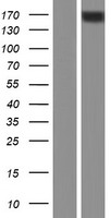 ABCC10 Protein - Western validation with an anti-DDK antibody * L: Control HEK293 lysate R: Over-expression lysate