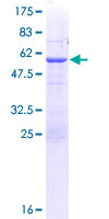 ABCC10 Protein - 12.5% SDS-PAGE of human ABCC10 stained with Coomassie Blue