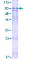 ABCC11 / MRP8 Protein - 12.5% SDS-PAGE of human ABCC11 stained with Coomassie Blue