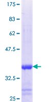 ABCC11 / MRP8 Protein - 12.5% SDS-PAGE Stained with Coomassie Blue.