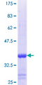 ABCC11 / MRP8 Protein - 12.5% SDS-PAGE Stained with Coomassie Blue.