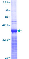 ABCC2 / MRP2 Protein - 12.5% SDS-PAGE Stained with Coomassie Blue.