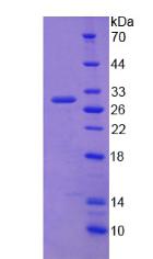 ABCC2 / MRP2 Protein - Recombinant ATP Binding Cassette Transporter C2 By SDS-PAGE