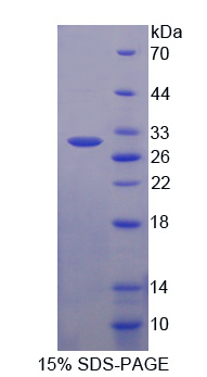 ABCC3 / MRP3 Protein - Recombinant  ATP Binding Cassette TransPorter C3 By SDS-PAGE