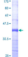 ABCC4 / MRP4 Protein - 12.5% SDS-PAGE Stained with Coomassie Blue.