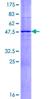 ABCC5 / MRP5 Protein - 12.5% SDS-PAGE of human ABCC5 stained with Coomassie Blue
