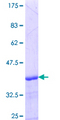 ABCC5 / MRP5 Protein - 12.5% SDS-PAGE Stained with Coomassie Blue.