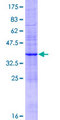 ABCC6 / MRP6 Protein - 12.5% SDS-PAGE of human ABCC6 stained with Coomassie Blue
