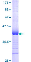 ABCC6 / MRP6 Protein - 12.5% SDS-PAGE Stained with Coomassie Blue.