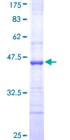 ABCC8 / SUR1 Protein - 12.5% SDS-PAGE Stained with Coomassie Blue.