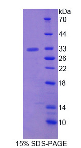 ABCC8 / SUR1 Protein - Recombinant ATP Binding Cassette Transporter C8 By SDS-PAGE