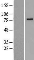 ABCD2 / ALDR Protein - Western validation with an anti-DDK antibody * L: Control HEK293 lysate R: Over-expression lysate