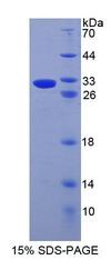 ABCD4 Protein - Recombinant ATP Binding Cassette Transporter D4 (ABCD4) by SDS-PAGE