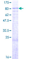 ABCE1 Protein - 12.5% SDS-PAGE of human ABCE1 stained with Coomassie Blue