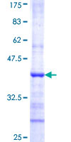 ABCE1 Protein - 12.5% SDS-PAGE Stained with Coomassie Blue.
