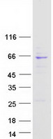 ABCE1 Protein - Purified recombinant protein ABCE1 was analyzed by SDS-PAGE gel and Coomassie Blue Staining