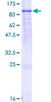 ABCF2 Protein - 12.5% SDS-PAGE of human ABCF2 stained with Coomassie Blue