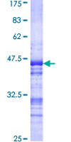 ABCF2 Protein - 12.5% SDS-PAGE Stained with Coomassie Blue.