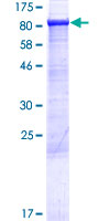ABCF3 Protein - 12.5% SDS-PAGE of human ABCF3 stained with Coomassie Blue