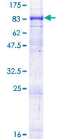 ABCG1 Protein - 12.5% SDS-PAGE of human ABCG1 stained with Coomassie Blue