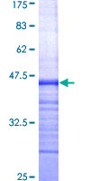 ABCG1 Protein - 12.5% SDS-PAGE Stained with Coomassie Blue.