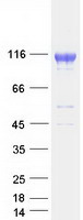 ABCG1 Protein - Purified recombinant protein ABCG1 was analyzed by SDS-PAGE gel and Coomassie Blue Staining