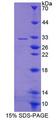 ABCG4 Protein - Recombinant ATP Binding Cassette Transporter G4 (ABCG4) by SDS-PAGE