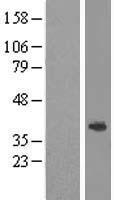 ABHD1 Protein - Western validation with an anti-DDK antibody * L: Control HEK293 lysate R: Over-expression lysate