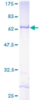 ABHD1 Protein - 12.5% SDS-PAGE of human ABHD1 stained with Coomassie Blue