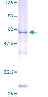 ABHD10 Protein - 12.5% SDS-PAGE of human ABHD10 stained with Coomassie Blue