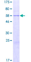 ABHD11 Protein - 12.5% SDS-PAGE of human ABHD11 stained with Coomassie Blue