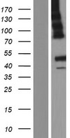 ABHD12 Protein - Western validation with an anti-DDK antibody * L: Control HEK293 lysate R: Over-expression lysate