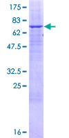 ABHD12 Protein - 12.5% SDS-PAGE of human ABHD12 stained with Coomassie Blue