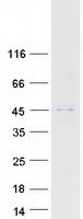 ABHD12 Protein - Purified recombinant protein ABHD12 was analyzed by SDS-PAGE gel and Coomassie Blue Staining
