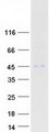 ABHD12 Protein - Purified recombinant protein ABHD12 was analyzed by SDS-PAGE gel and Coomassie Blue Staining