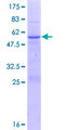 ABHD12B Protein - 12.5% SDS-PAGE of human ABHD12B stained with Coomassie Blue