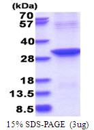 ABHD12B Protein