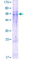 ABHD13 Protein - 12.5% SDS-PAGE of human ABHD13 stained with Coomassie Blue