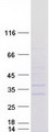 ABHD14A Protein - Purified recombinant protein ABHD14A was analyzed by SDS-PAGE gel and Coomassie Blue Staining