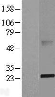 ABHD14B Protein - Western validation with an anti-DDK antibody * L: Control HEK293 lysate R: Over-expression lysate