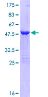 ABHD14B Protein - 12.5% SDS-PAGE of human ABHD14B stained with Coomassie Blue