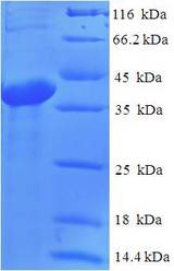 ABHD14B Protein