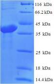 ABHD14B Protein