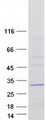 ABHD14B Protein - Purified recombinant protein ABHD14B was analyzed by SDS-PAGE gel and Coomassie Blue Staining