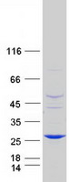 ABHD14B Protein - Purified recombinant protein ABHD14B was analyzed by SDS-PAGE gel and Coomassie Blue Staining